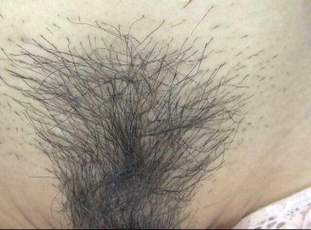 100人のまん毛 第9集 サンプル画像 14