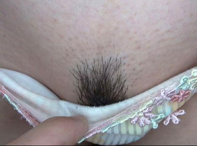 100人のまん毛 第9集 サンプル画像 18