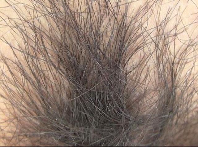 100人のまん毛 第9集 サンプル画像 2