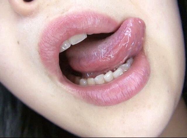 100人のおくち 第9集 サンプル画像 1
