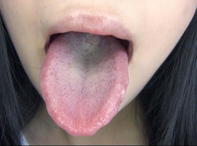 100人のおくち 第9集 サンプル画像 14