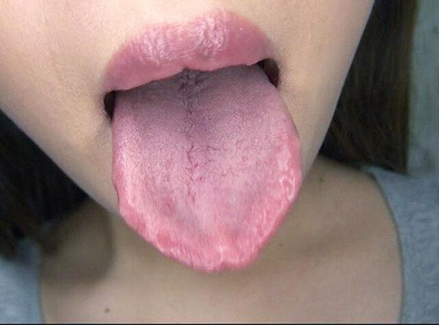 100人のおくち 第9集 サンプル画像 17