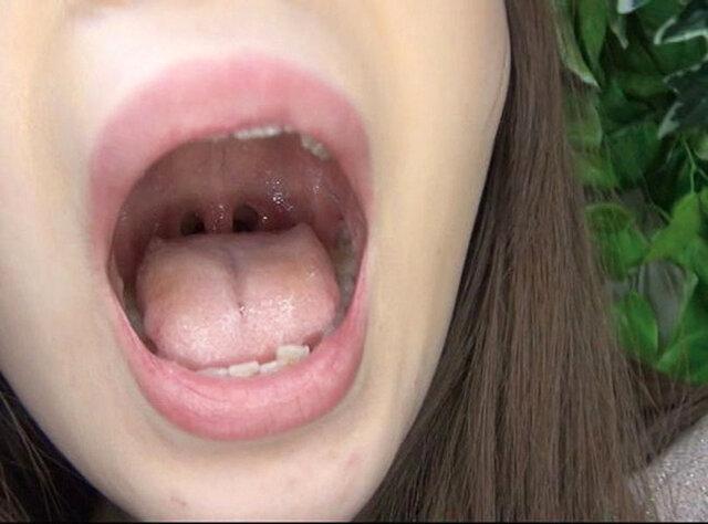 100人のおくち 第9集 サンプル画像 2