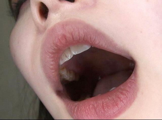 100人のおくち 第9集 サンプル画像 4