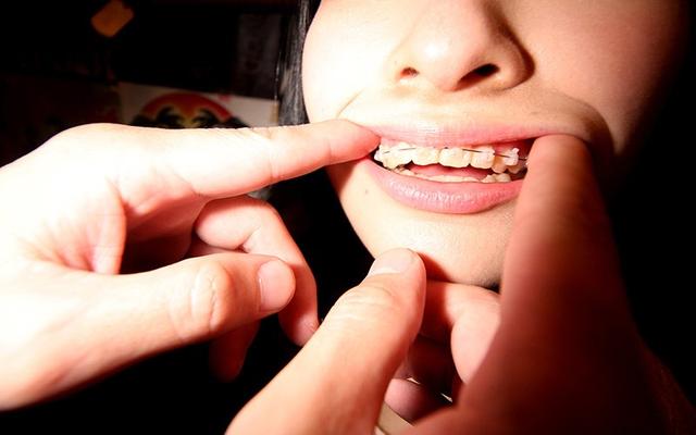 【歯の矯正女子】現役女子大生の美人デリ嬢呼んだら就活前で歯の矯正中だった件 愛しのデリヘル嬢28【DQN】素人売春生中出し 盗撮強●撮り下ろし 中条鈴華 サンプル画像 13