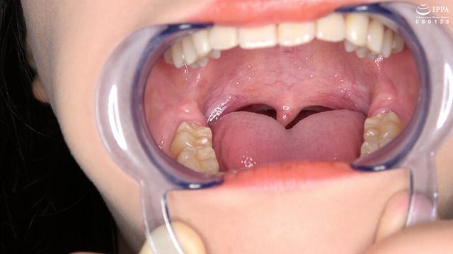 歯・口内・のどちんこ・唾観察 角名つむぎ サンプル画像 11