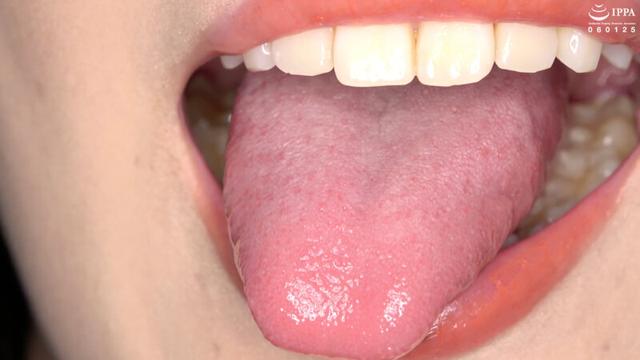 歯・口内・のどちんこ・唾観察 角名つむぎ サンプル画像 5