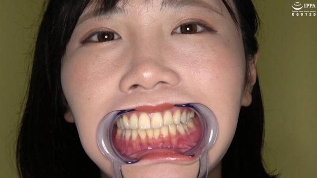 歯・口内・のどちんこ・唾観察 角名つむぎ サンプル画像 7