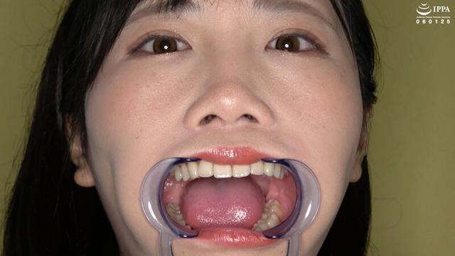 歯・口内・のどちんこ・唾観察 角名つむぎ サンプル画像 9