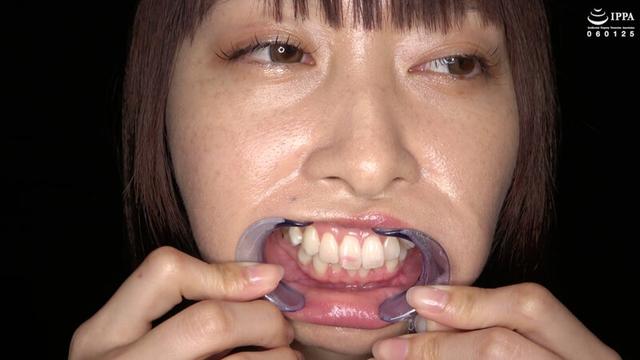 口内・歯・のどちんこ観察 堂本未來 サンプル画像 12