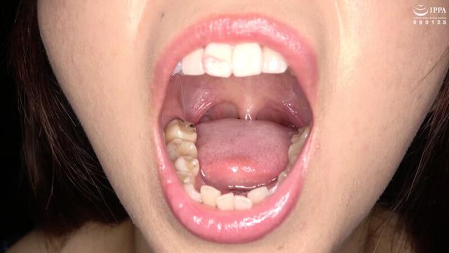 口内・歯・のどちんこ観察 堂本未來 サンプル画像 5