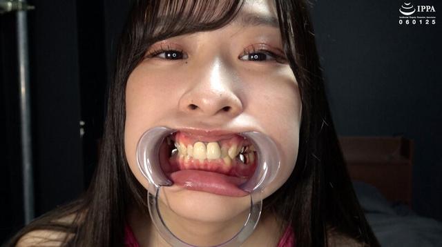 【歯＆口腔】人気女優 朝比ゆのチャンの歯＆口腔＆のどちんこ観察と小魚舐め！ サンプル画像 4