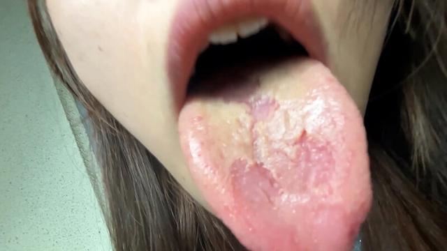 街角で声をかけて口内観察させてもらう 大学生 ゆゆちゃん サンプル画像 15