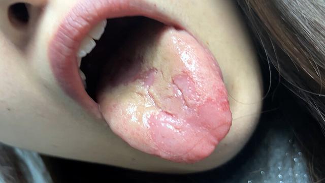 街角で声をかけて口内観察させてもらう 大学生 ゆゆちゃん サンプル画像 20
