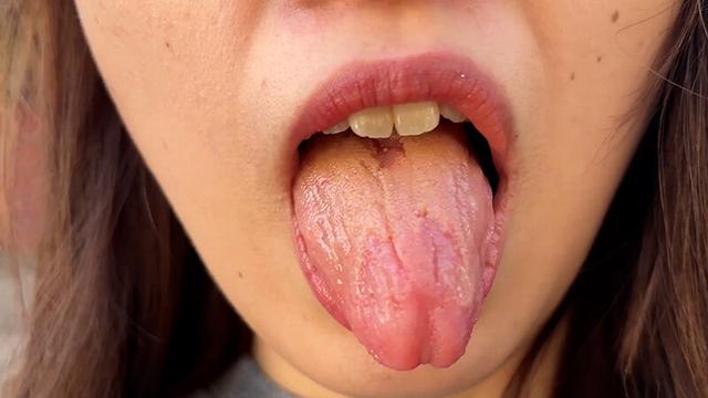 街角で声をかけて口内観察させてもらう 大学生 ゆゆちゃん サンプル画像 6