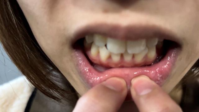 街角で声をかけて口内観察させてもらう オーガニックスーパー勤務 はつみちゃん サンプル画像 12