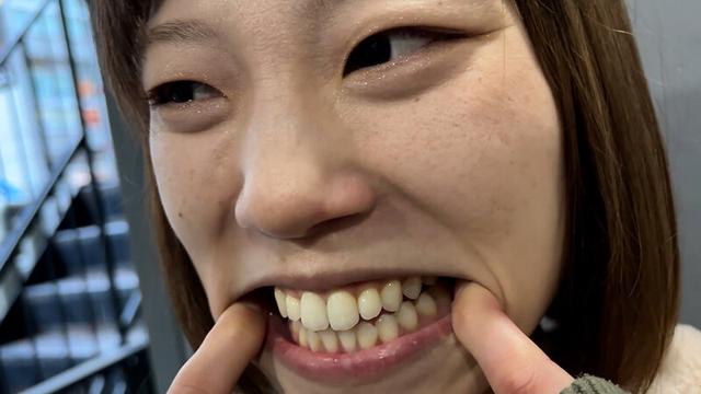 街角で声をかけて口内観察させてもらう オーガニックスーパー勤務 はつみちゃん サンプル画像 13