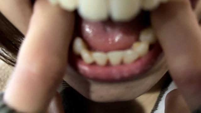 街角で声をかけて口内観察させてもらう オーガニックスーパー勤務 はつみちゃん サンプル画像 14