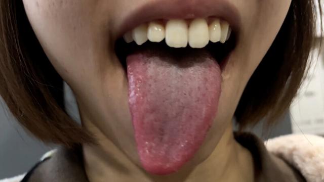 街角で声をかけて口内観察させてもらう オーガニックスーパー勤務 はつみちゃん サンプル画像 16