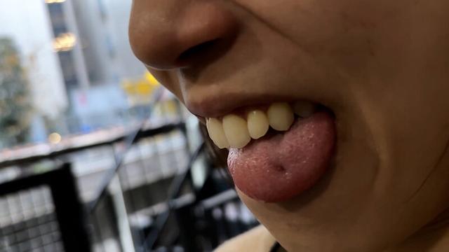 街角で声をかけて口内観察させてもらう オーガニックスーパー勤務 はつみちゃん サンプル画像 17