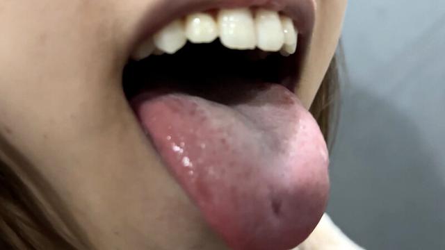 街角で声をかけて口内観察させてもらう オーガニックスーパー勤務 はつみちゃん サンプル画像 20