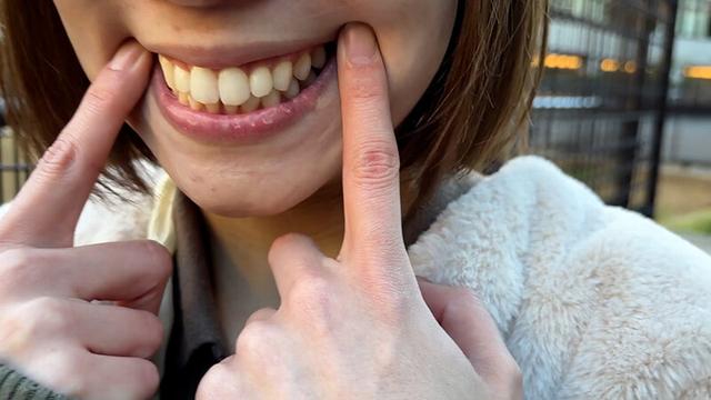 街角で声をかけて口内観察させてもらう オーガニックスーパー勤務 はつみちゃん サンプル画像 3