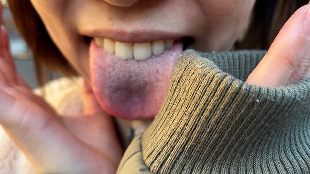 街角で声をかけて口内観察させてもらう オーガニックスーパー勤務 はつみちゃん サンプル画像 5
