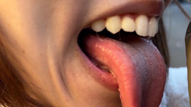 街角で声をかけて口内観察させてもらう オーガニックスーパー勤務 はつみちゃん サンプル画像 7