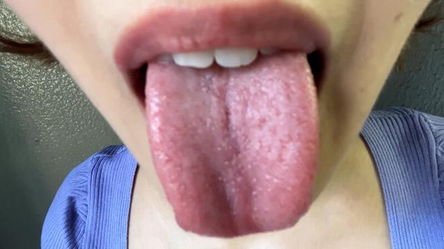 街角で声をかけて口内観察させてもらう アパレル店員 さつきちゃん サンプル画像 14