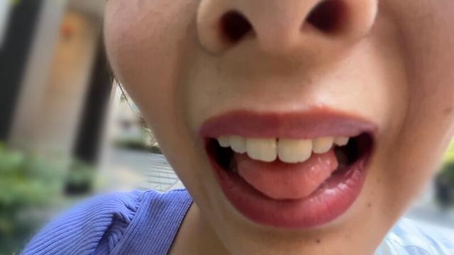 街角で声をかけて口内観察させてもらう アパレル店員 さつきちゃん サンプル画像 5