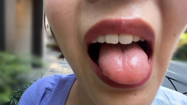 街角で声をかけて口内観察させてもらう アパレル店員 さつきちゃん サンプル画像 6