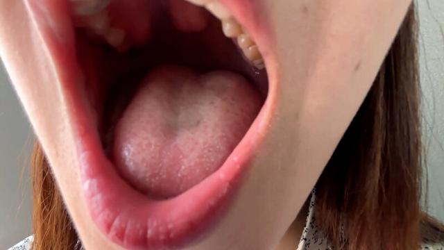 街角で声をかけて口内観察させてもらう ドラッグストア店員 あいるちゃん サンプル画像 5