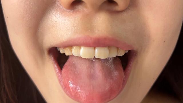 街角で声をかけて口内観察させてもらう アパレル店員 さゆりちゃん サンプル画像 9