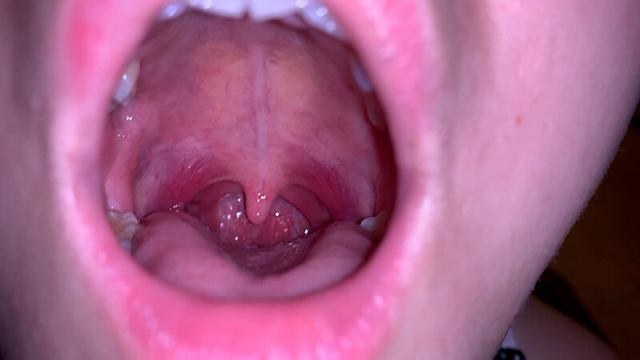 水沢つぐみの喉奥責め 腫れ気味な扁桃腺を… サンプル画像 2