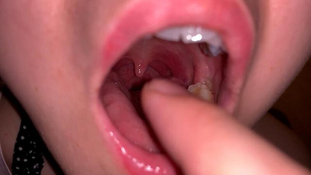 水沢つぐみの喉奥責め 腫れ気味な扁桃腺を… サンプル画像 4