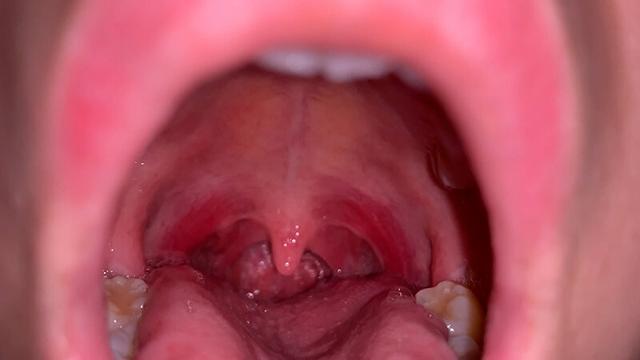 水沢つぐみの喉奥責め 腫れ気味な扁桃腺を… サンプル画像 7