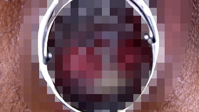 愛液ぐちゅぐちゅクスコで拡げておま○こオナニー サンプル画像 5