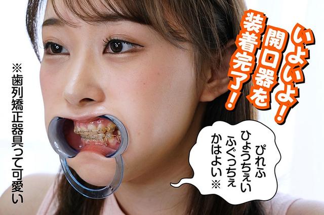 歯列矯正の女 長谷川古宵 サンプル画像 4